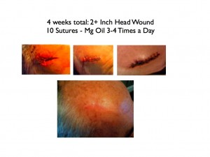 Does Magnesium (MgCl Oil) heal scars?!?…